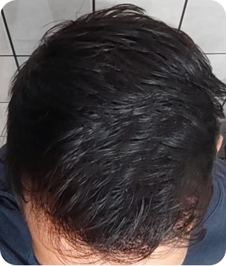Cliente Manual depois do tratamento