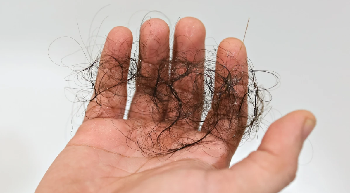 Mão segurando um tufo de cabelos que caíram