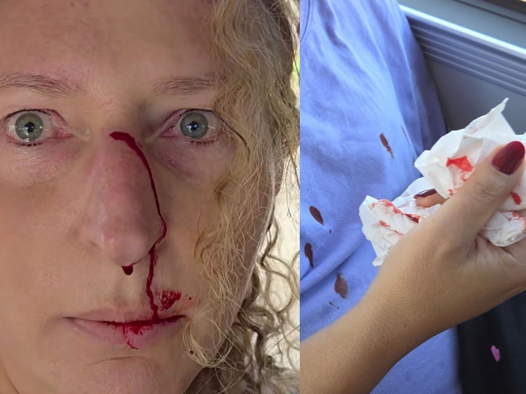 У Варшаві побили жінку, яка заступилася за українку в автобусі - фото 2