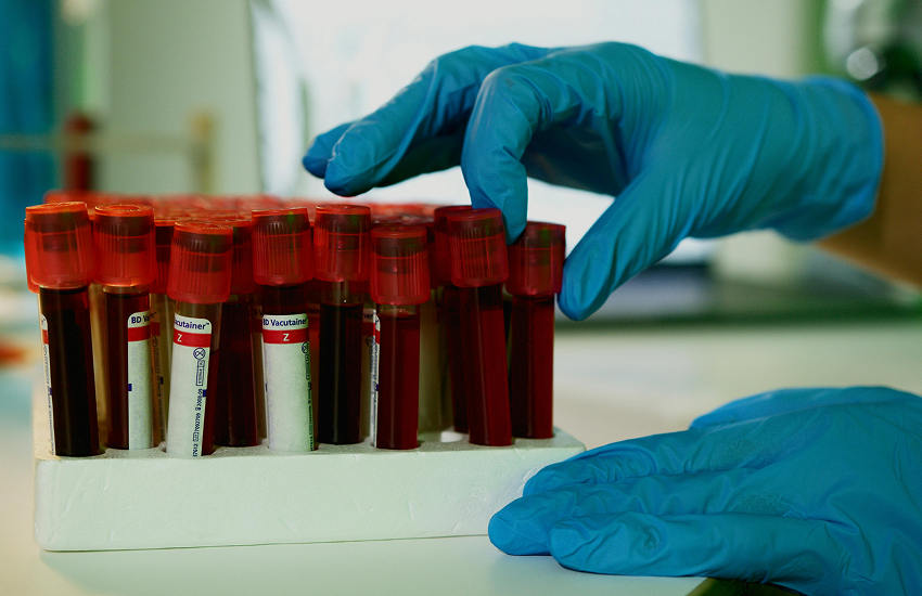 Preparing for Blood Tests While Pregnant