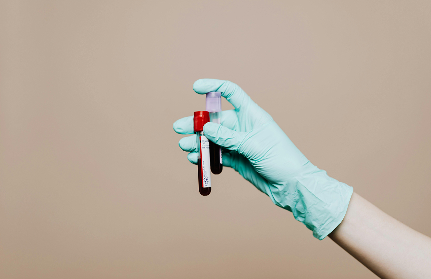 The Cost of Blood Testing: What to Expect
