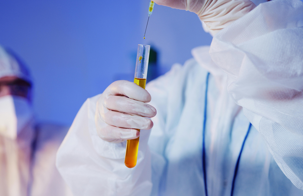 When Should You Fast Before a Urine Test?