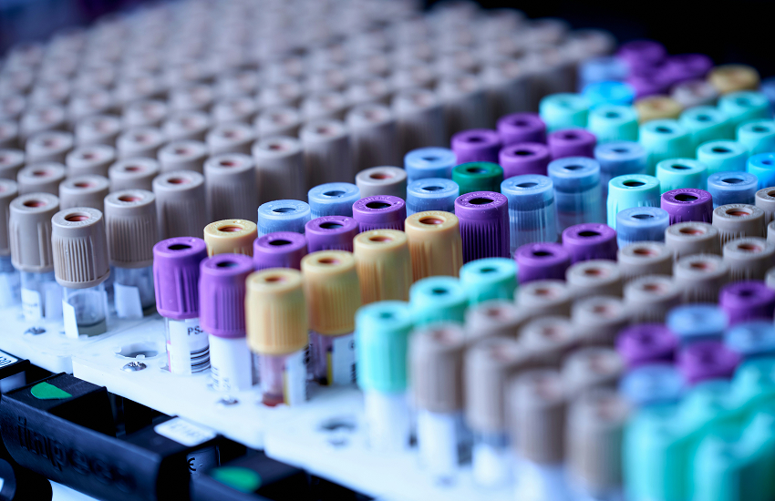 How Much Would a Full Blood Test Cost in Mont-Royal?
