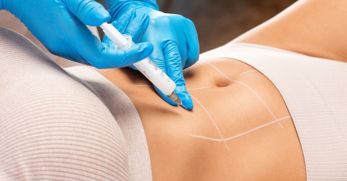 How Fast Do GLP‑1 Injections Work?