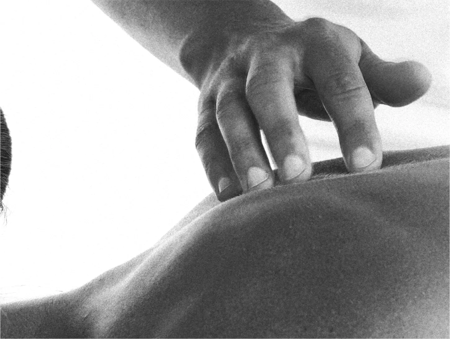 man doing acupuncture on back 