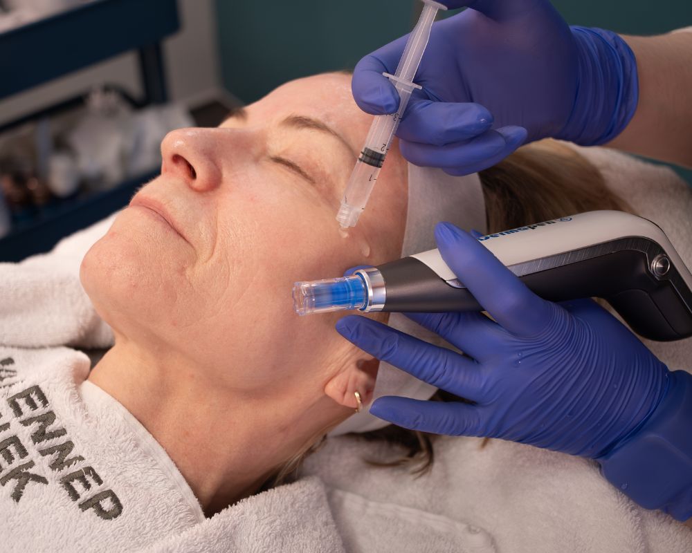 steviger en gladder huid