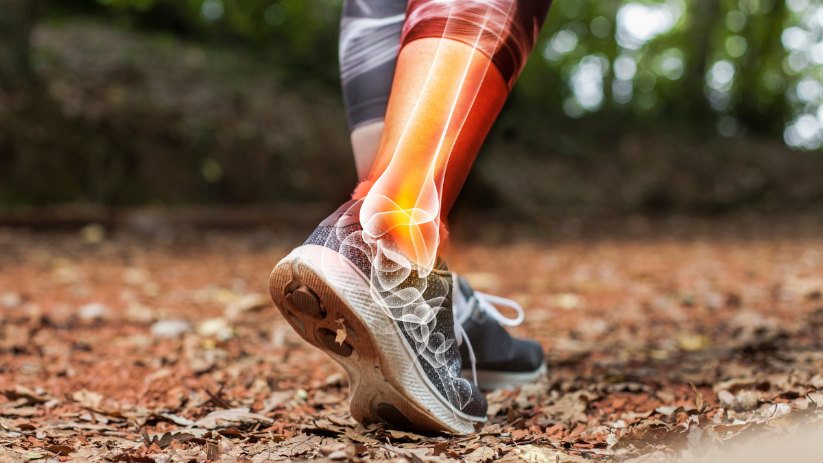 An image of a man's lower leg showing a computer image of what his bone looks like for orthopedic surgeons.
