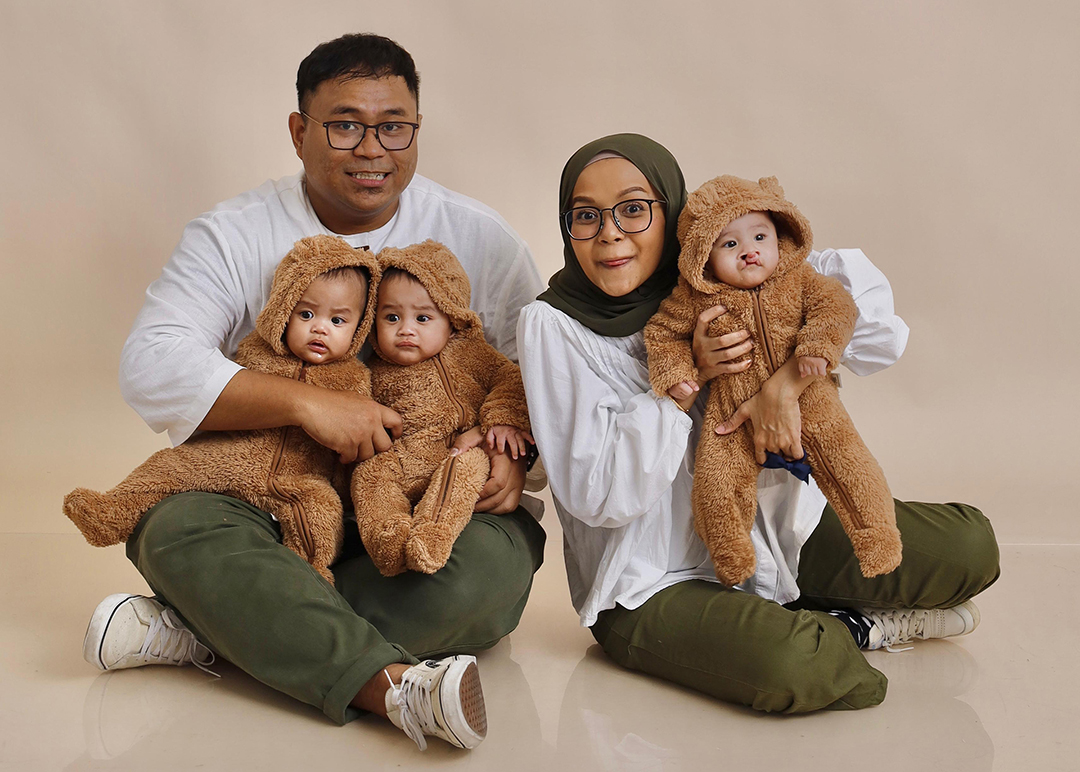 Triplet Baby André's Cleft Journey through Lip Repair, Palate Surgery, and Growing Up