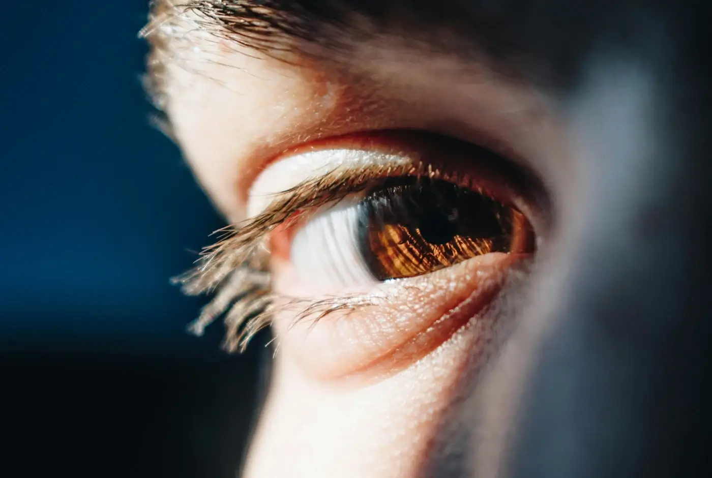 Cataract Surgery Vision