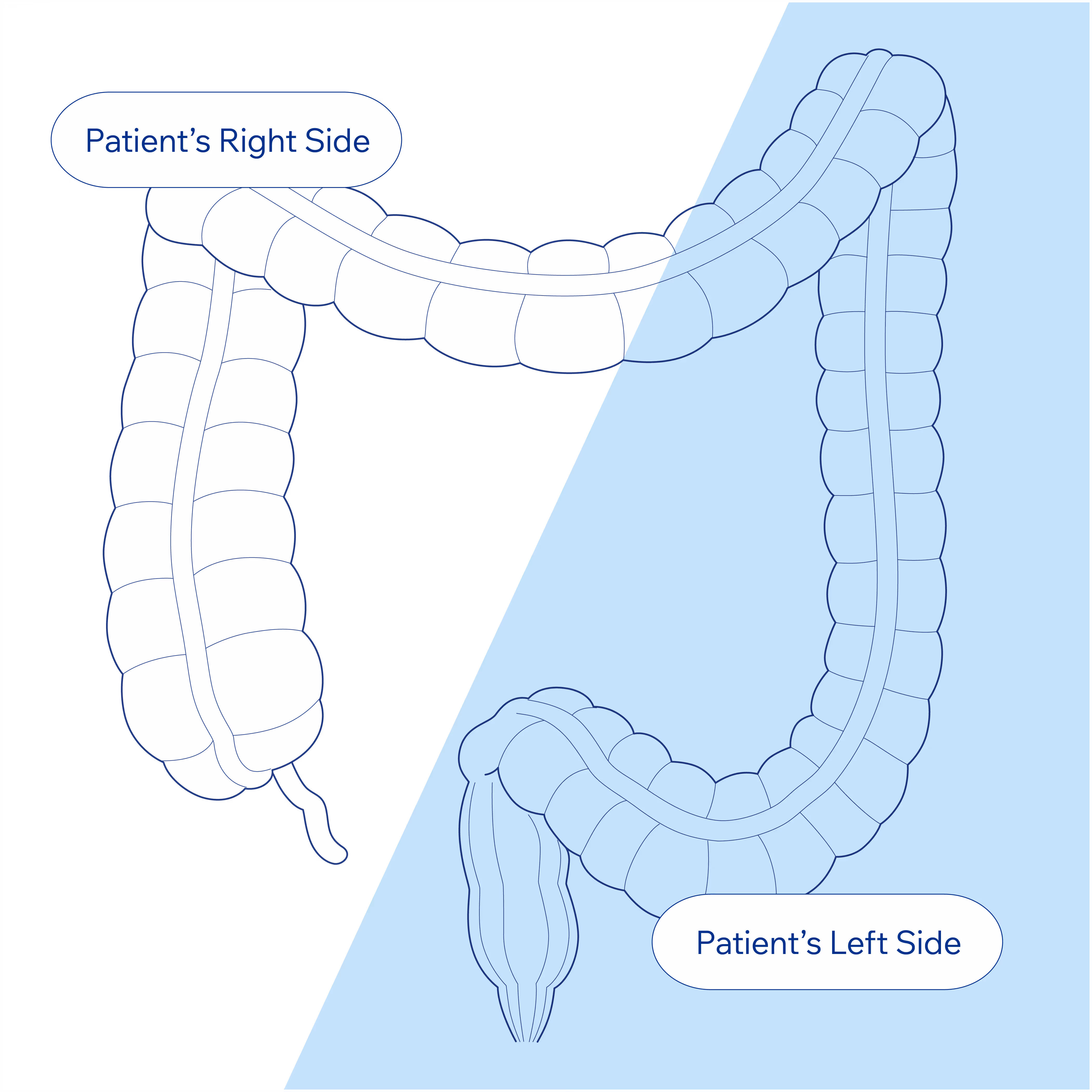 Left and right sided colon diagram