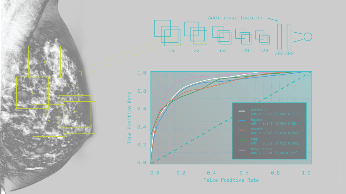 Image by Proxet, CNNs (Convolutional Neural Net) with the CADs in use