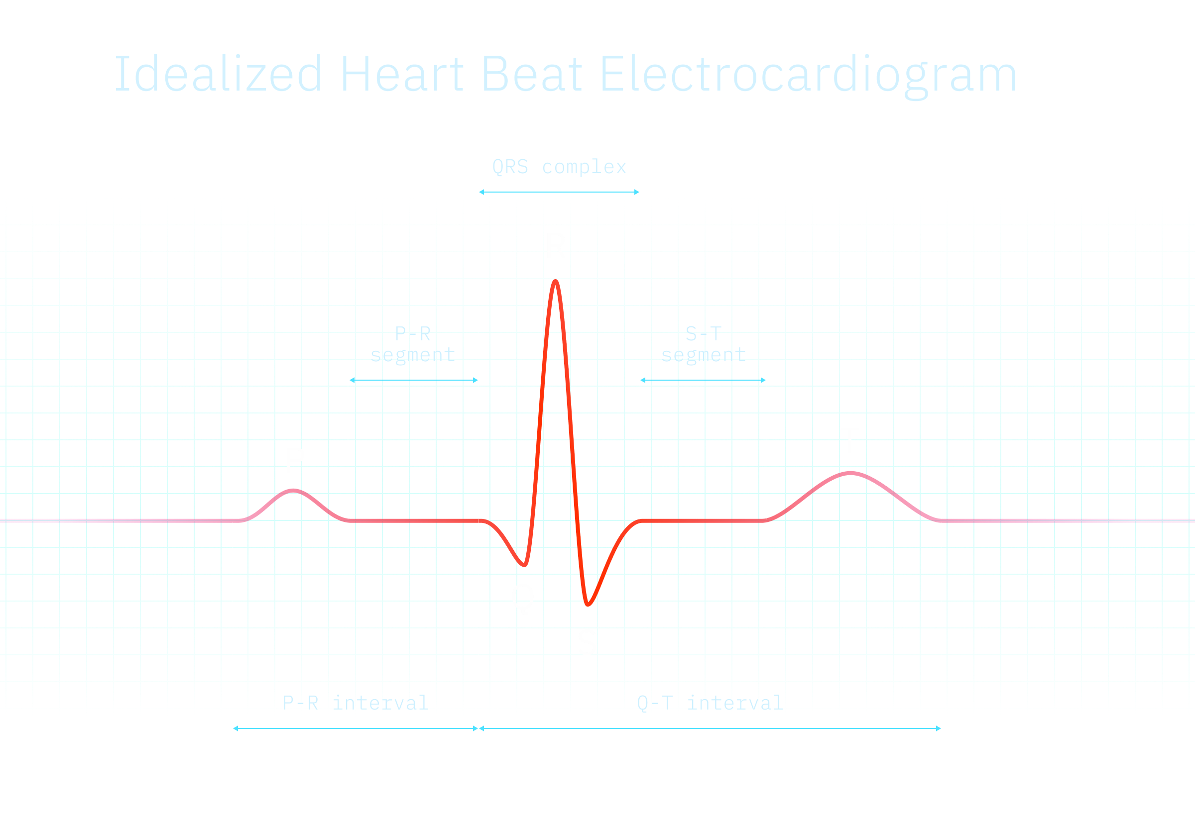 Image by Proxet. Idealized Heart Beat Electrocardiogram