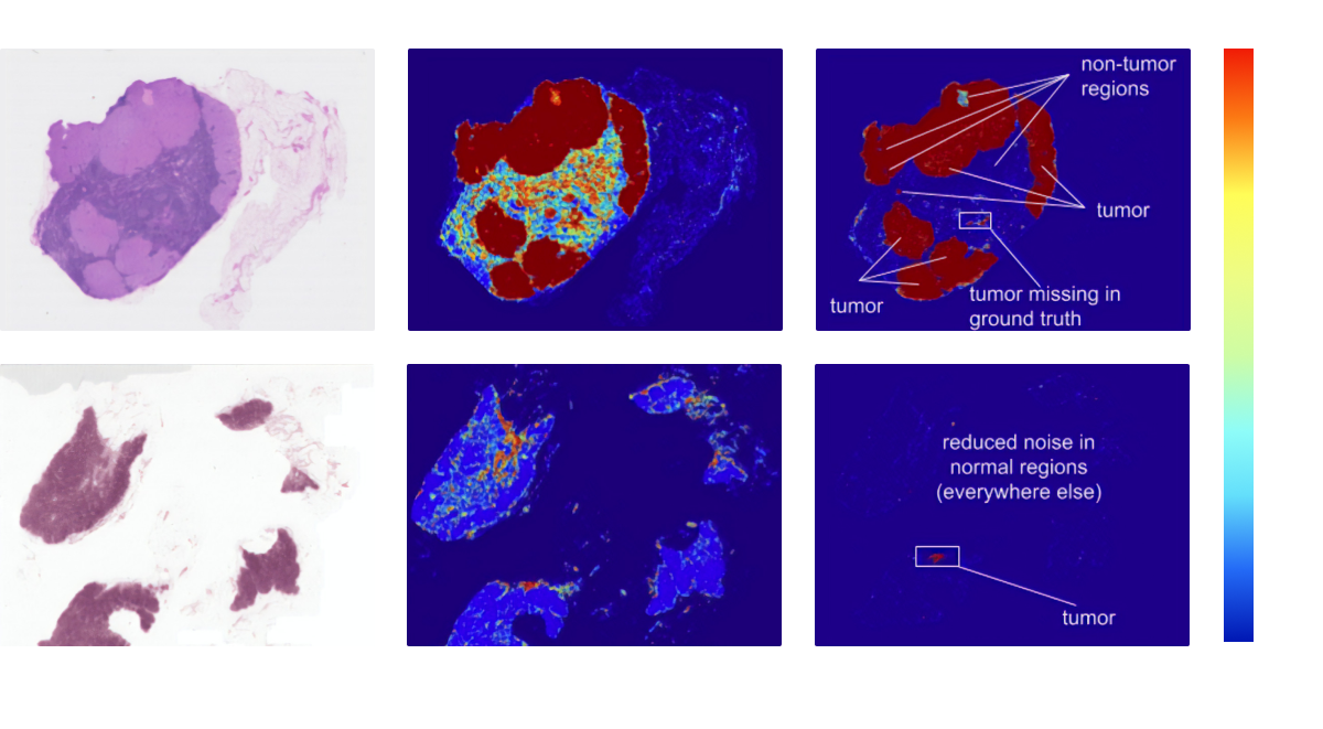 Image by Proxet. Lung Imaging Technology