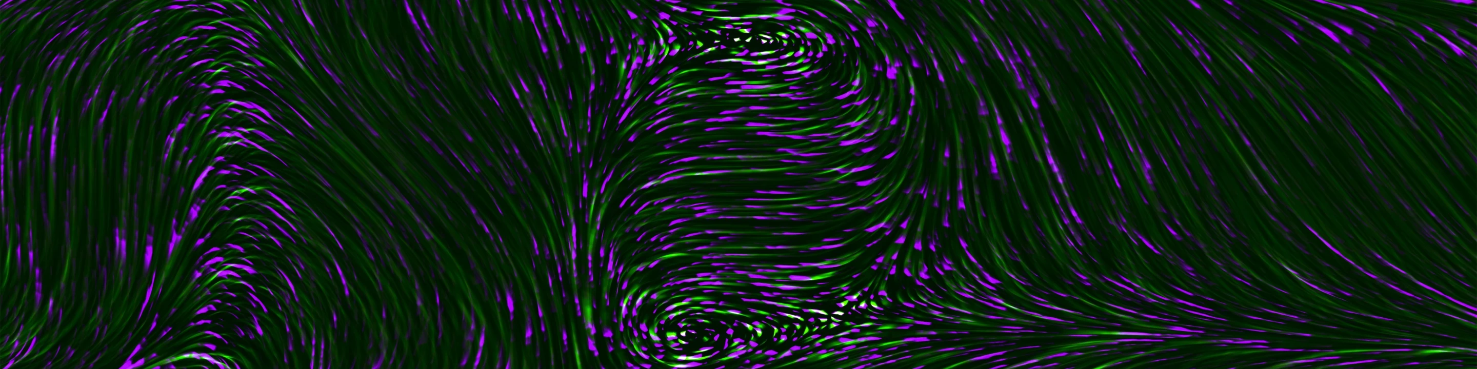 Integration of AI in Radiotherapy