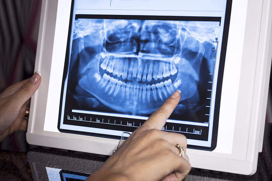 A person showing an X-ray of a person's teeth