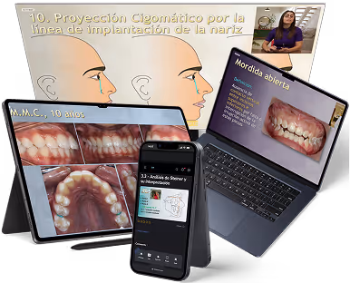 Collage of dental-related technology showing side profile illustrations with nasal implantation line, detailed teeth photos on tablet, a phone displaying dental analysis app, and a laptop with open bite dental case and a woman in a video call.