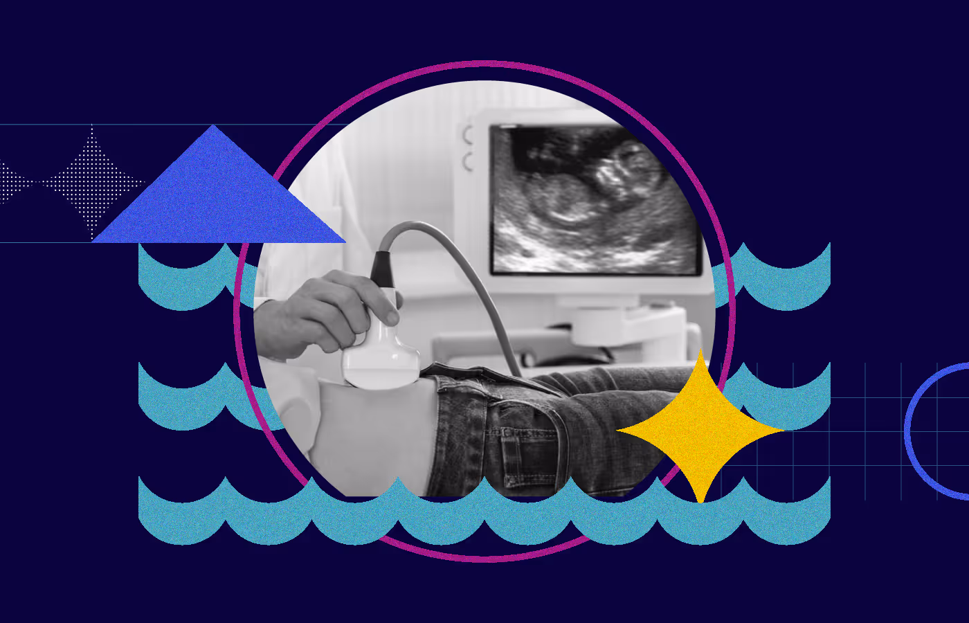 Guidea Femovate -  How BB imaging is Transforming Women’s Health: Improving health outcomes by making high-quality ultrasound services accessible, innovation for maternal health care deserts