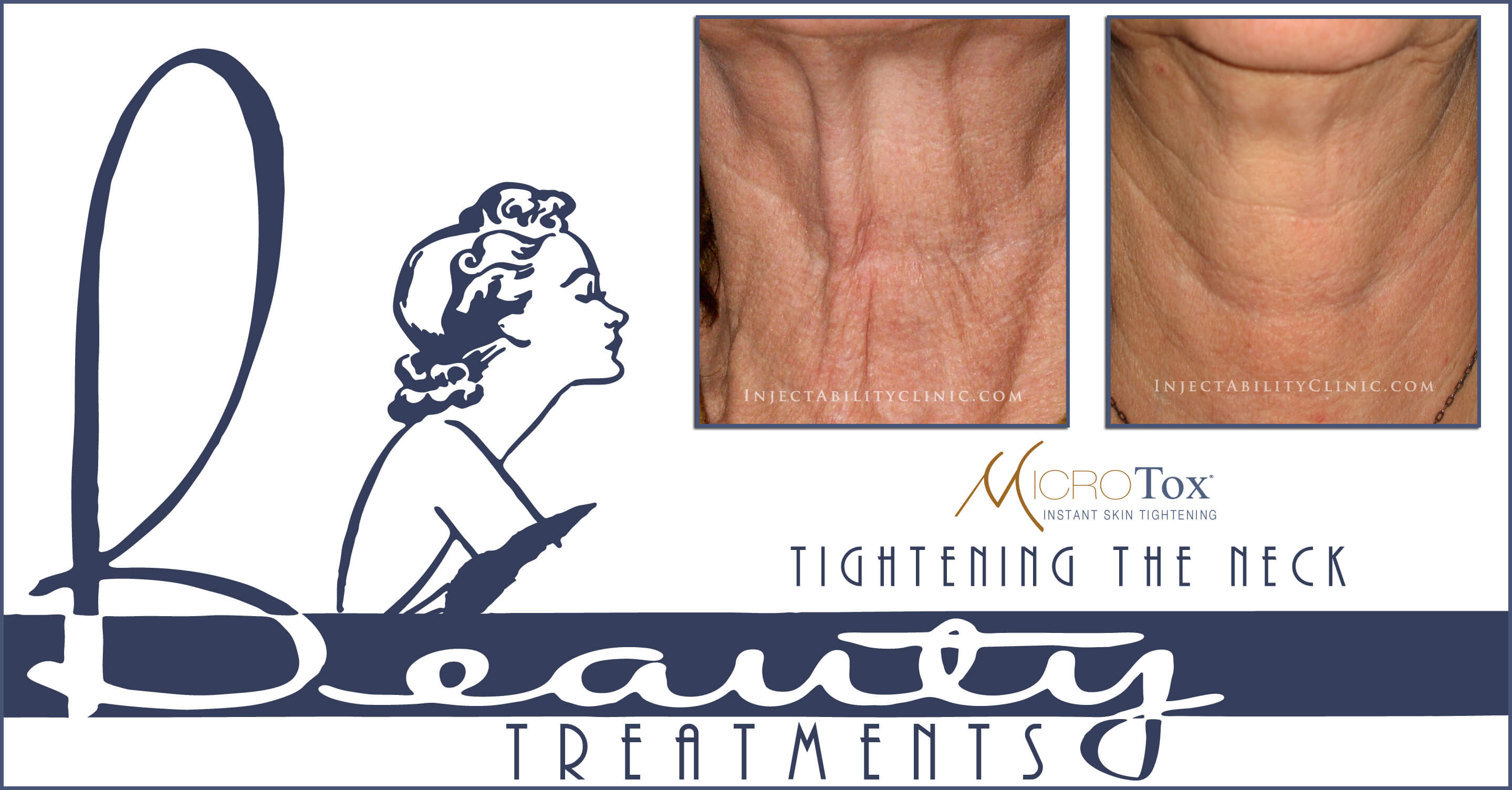 website Blank page edit