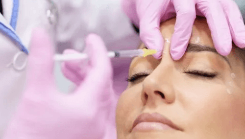 Rinomodelación: cómo mejorar la forma de la nariz sin cirugía