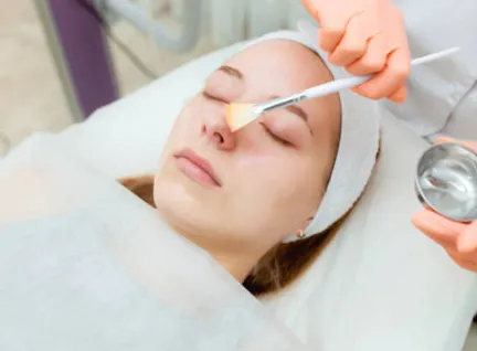 Peeling químico: renovación profunda y luminosidad para tu piel