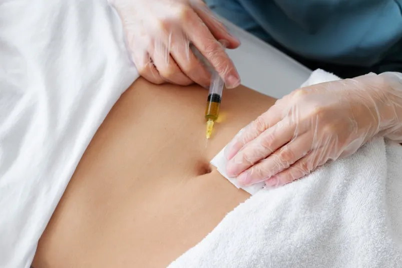 Mesoterapia facial y corporal: hidratación, firmeza y renovación desde el interior