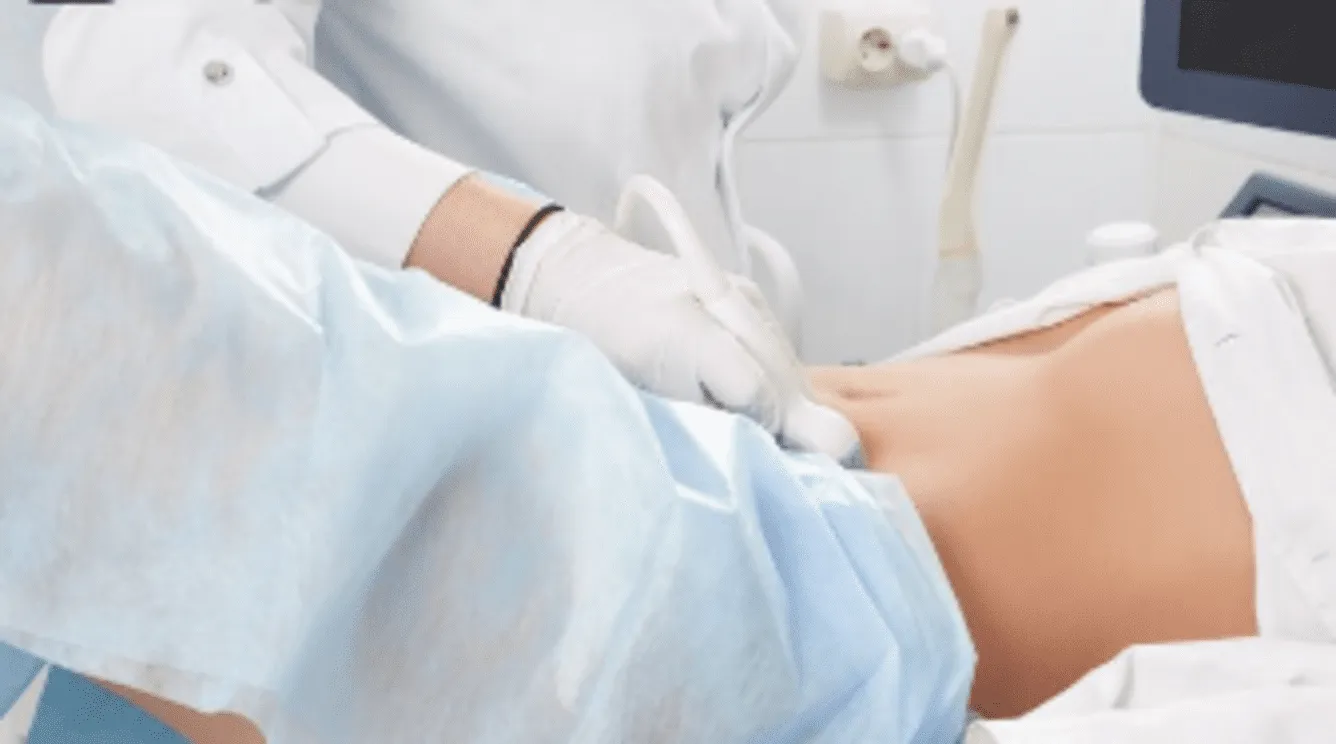 ¿Qué es la ginecoestética y cómo puede mejorar tu bienestar íntimo?