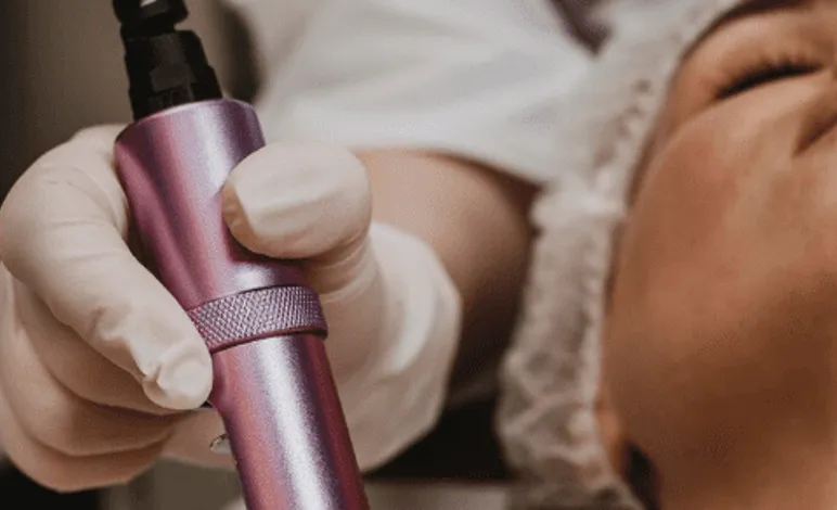 Resurfacing facial: renueva tu piel y recupera tu luminosidad