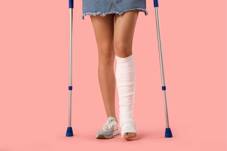 Vrouw met been in gips op krukken