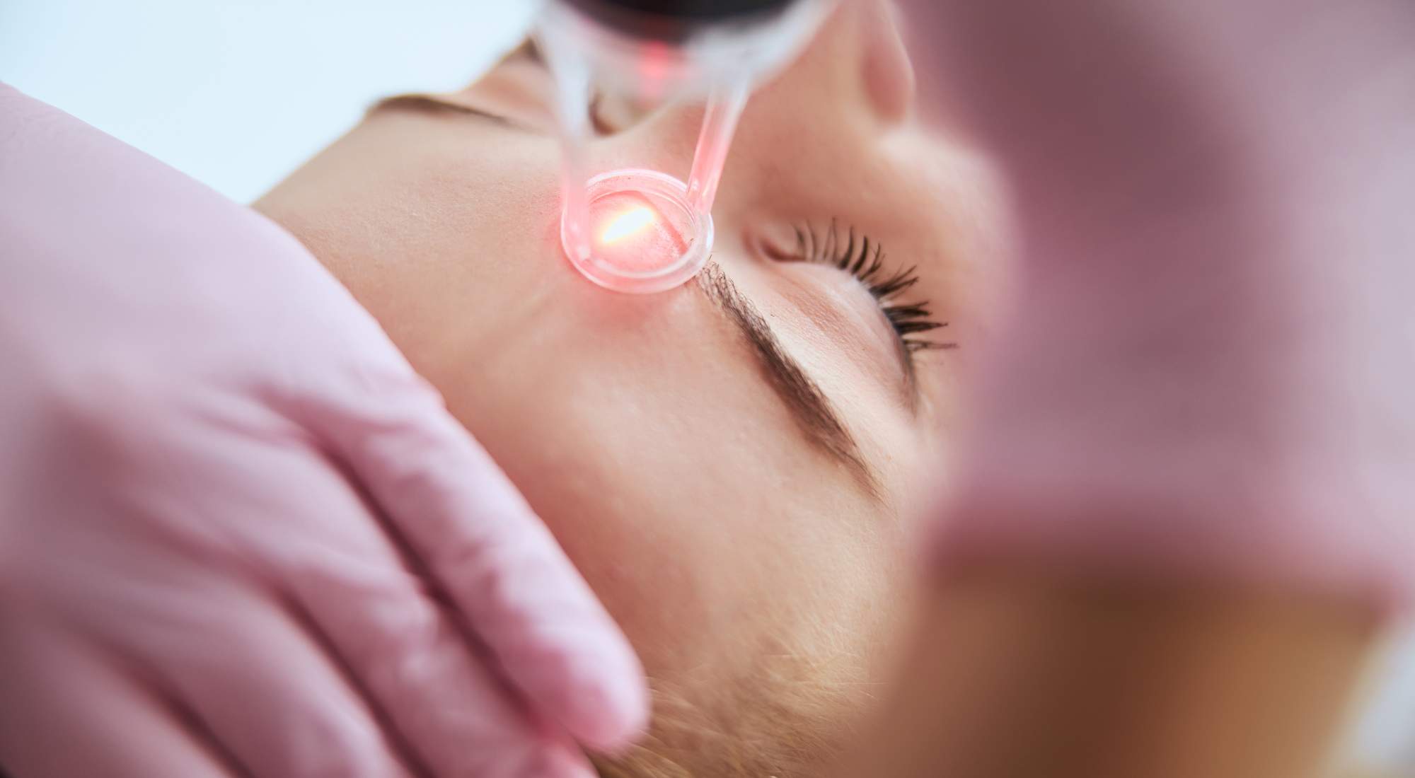 what is laser skin rejuvenation