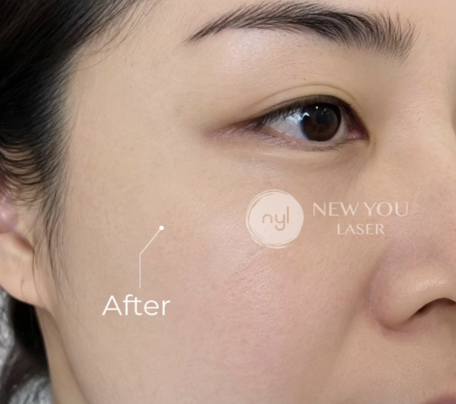 Client result after treatment