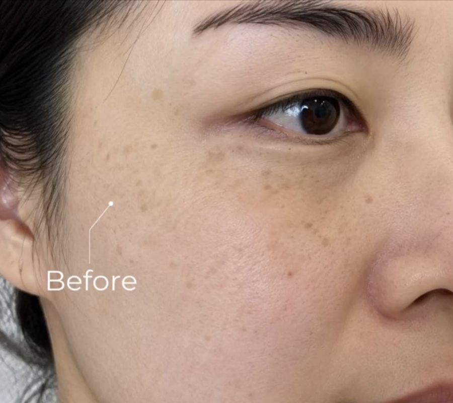 Client before treatment