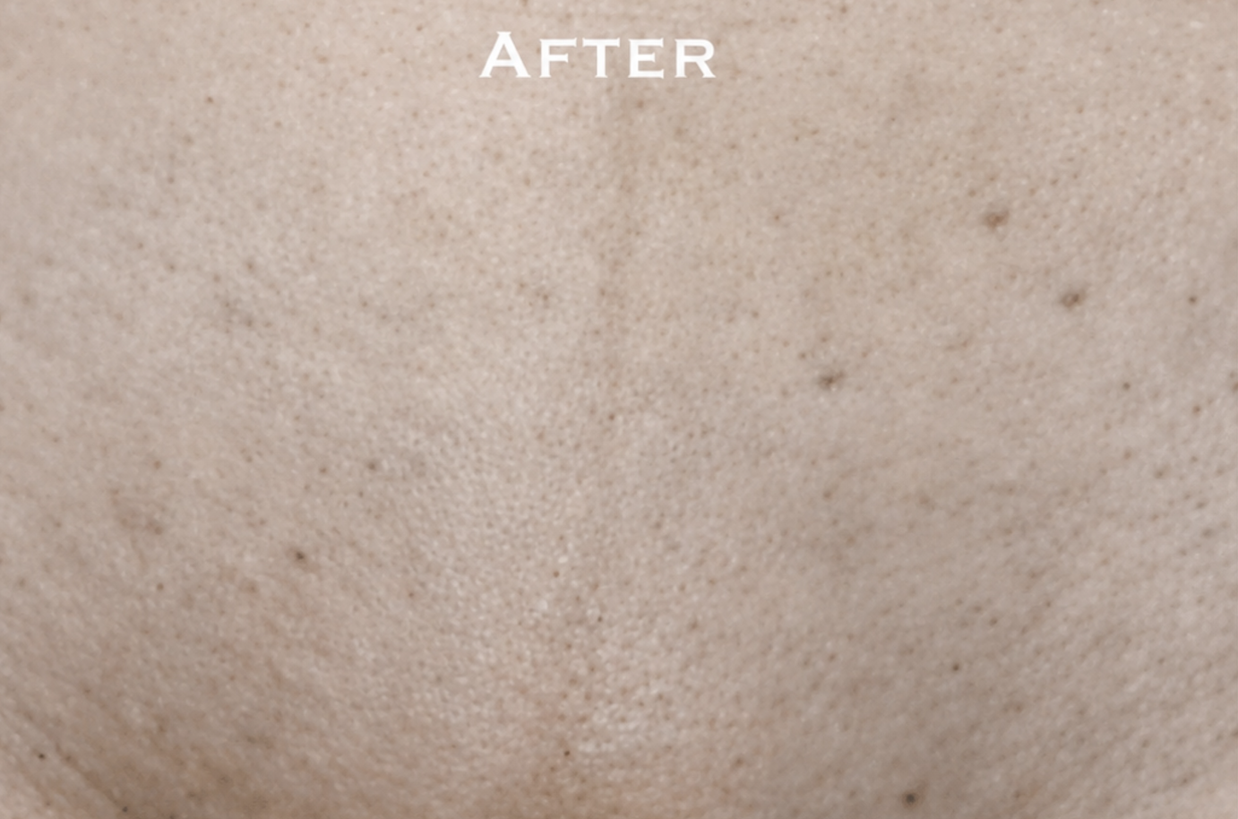 Client result after treatment