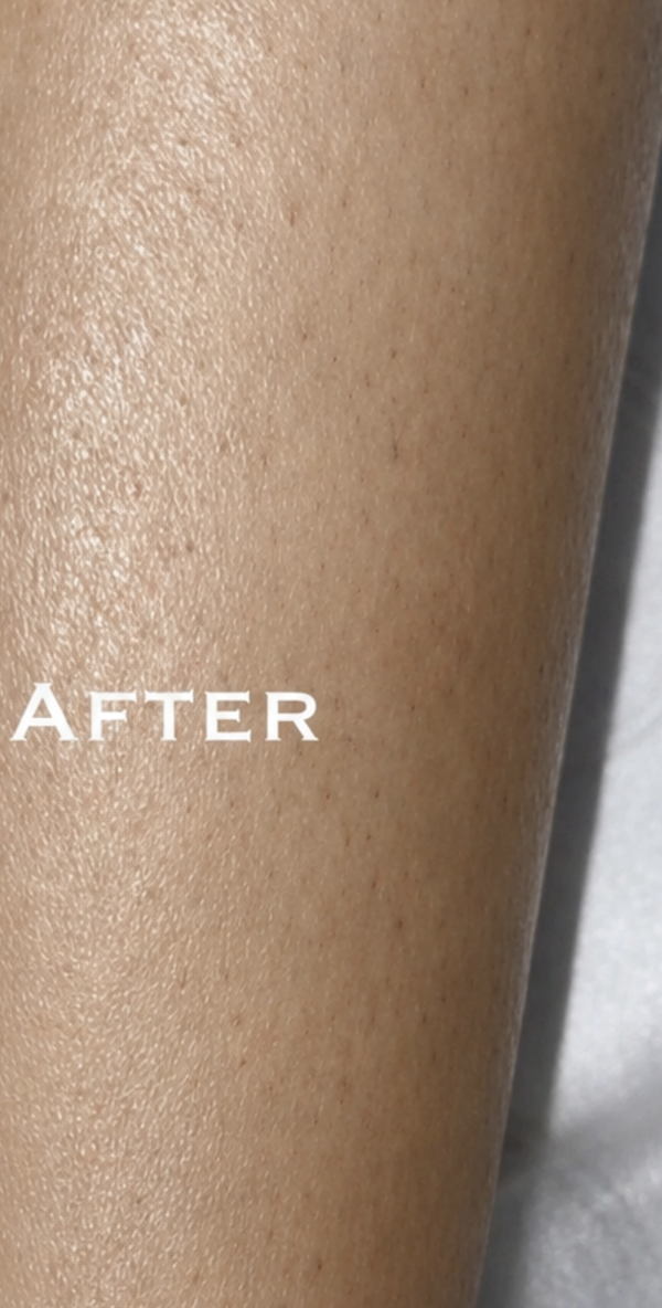 Client result after treatment