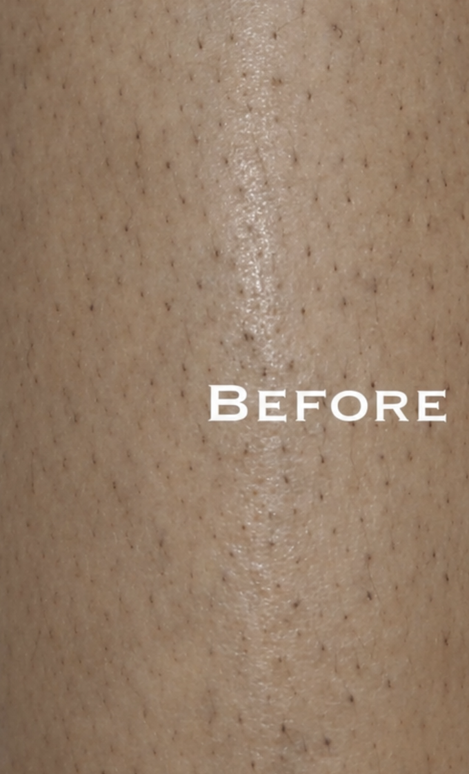 Client before treatment