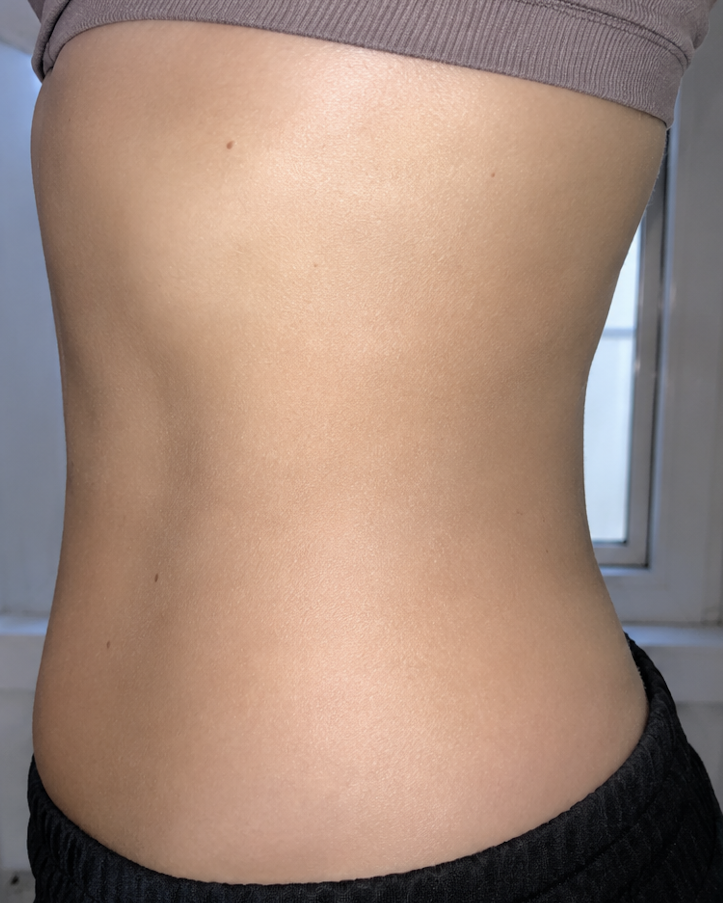 Client result after treatment