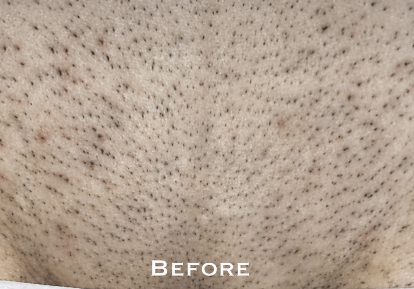 Client before treatment