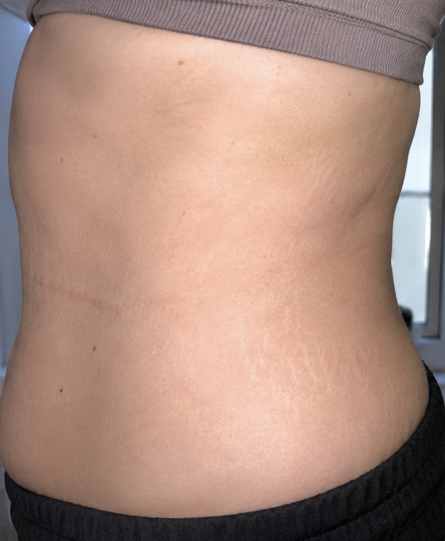 Client before treatment