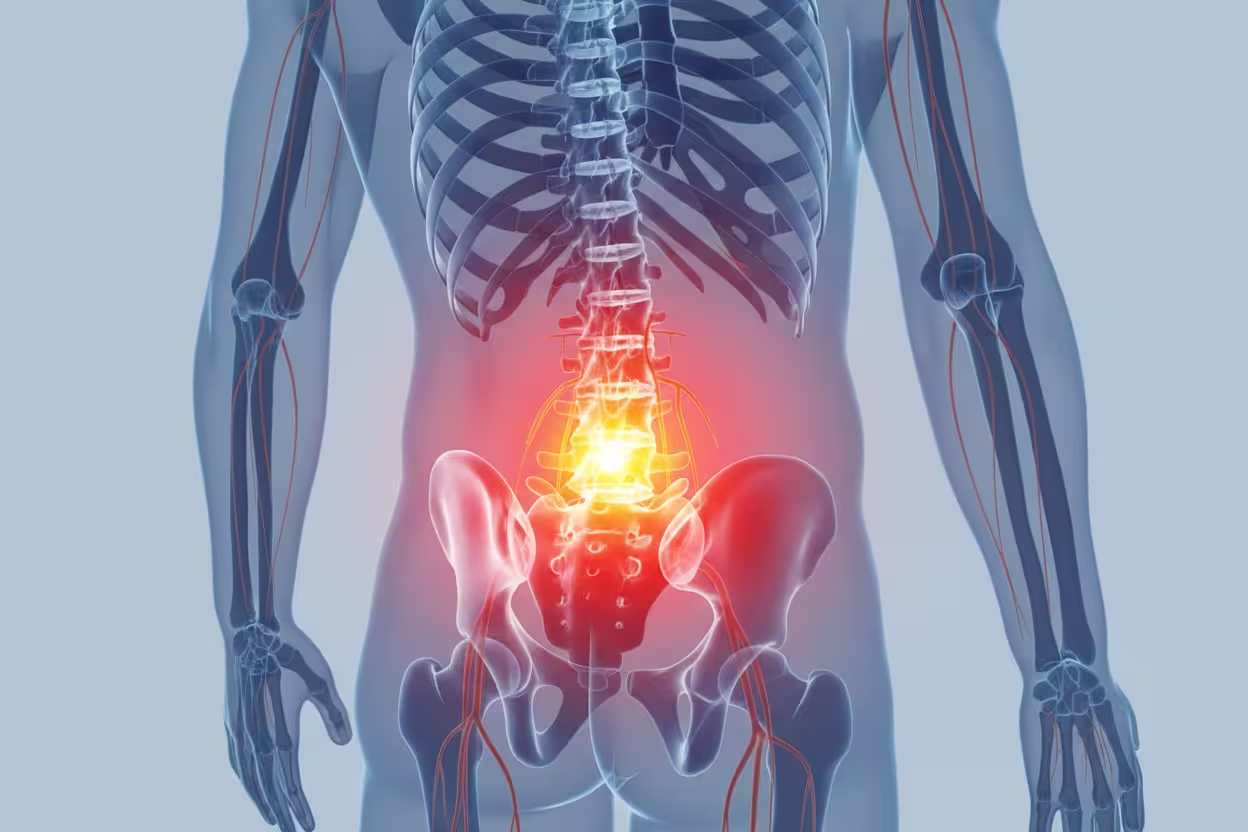 Transparent anatomical view of the human torso with highlighted lower spine in red and yellow, indicating pain or inflammation in the lower back area near the pelvis.