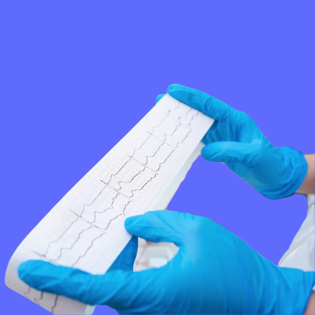 How to Read an EKG Strip: A Beginner's Guide