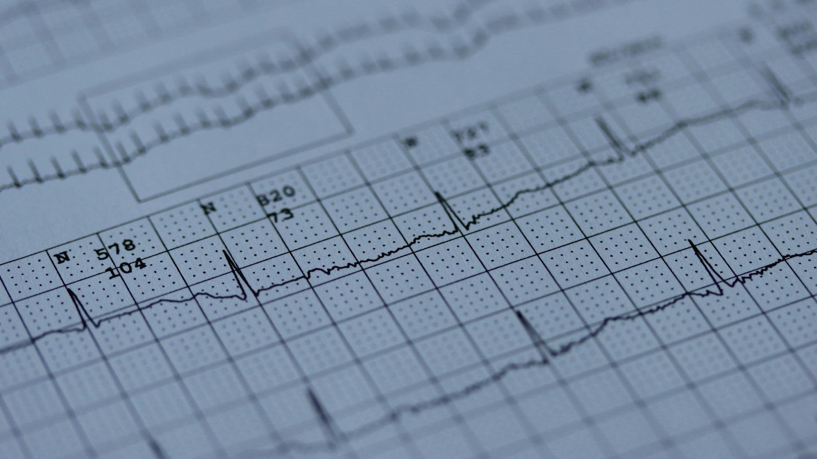 Maximizing Your EKG Tech Training: Tips for Optimizing Your Learning