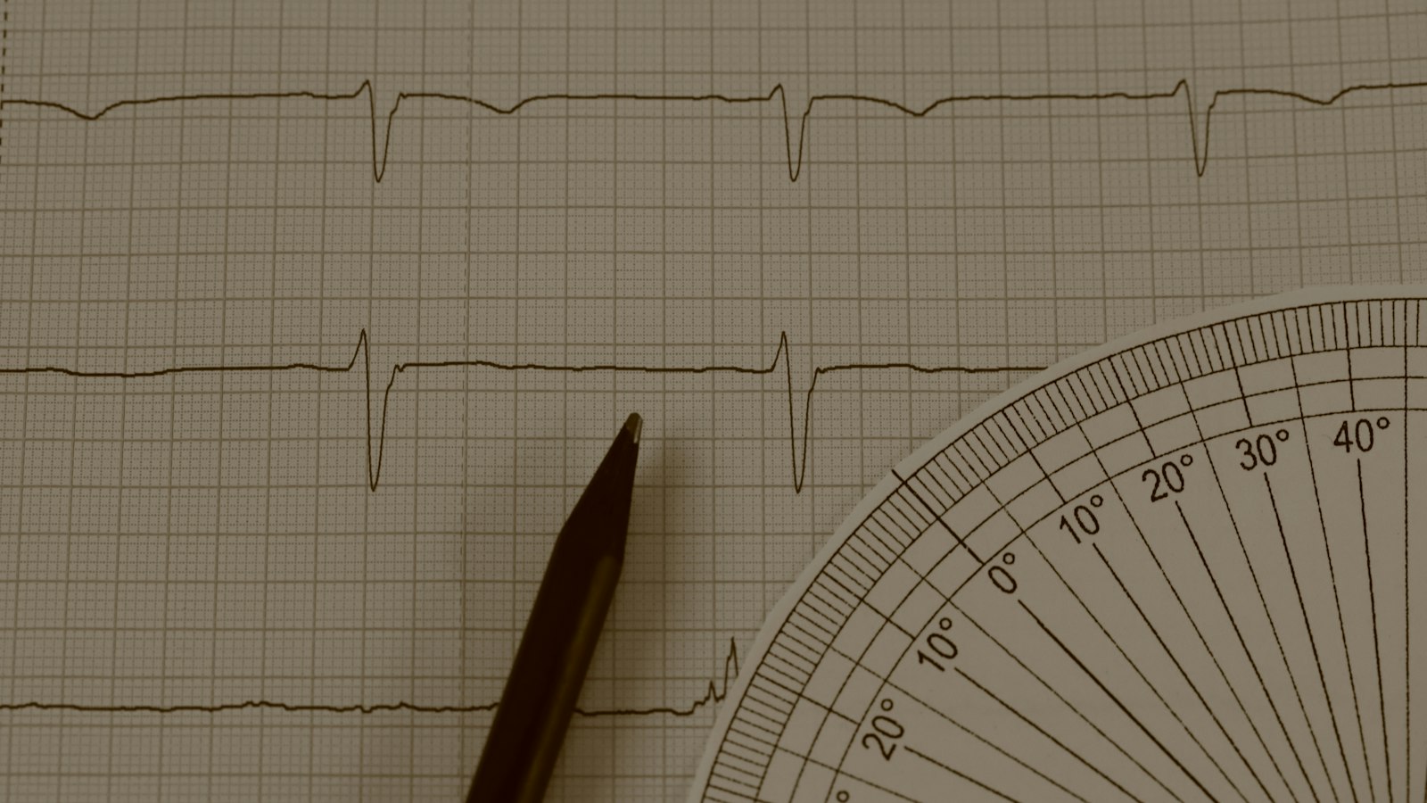 Navigating the Path to Becoming an EKG Technician in Florida: Affordable Programs and Certification