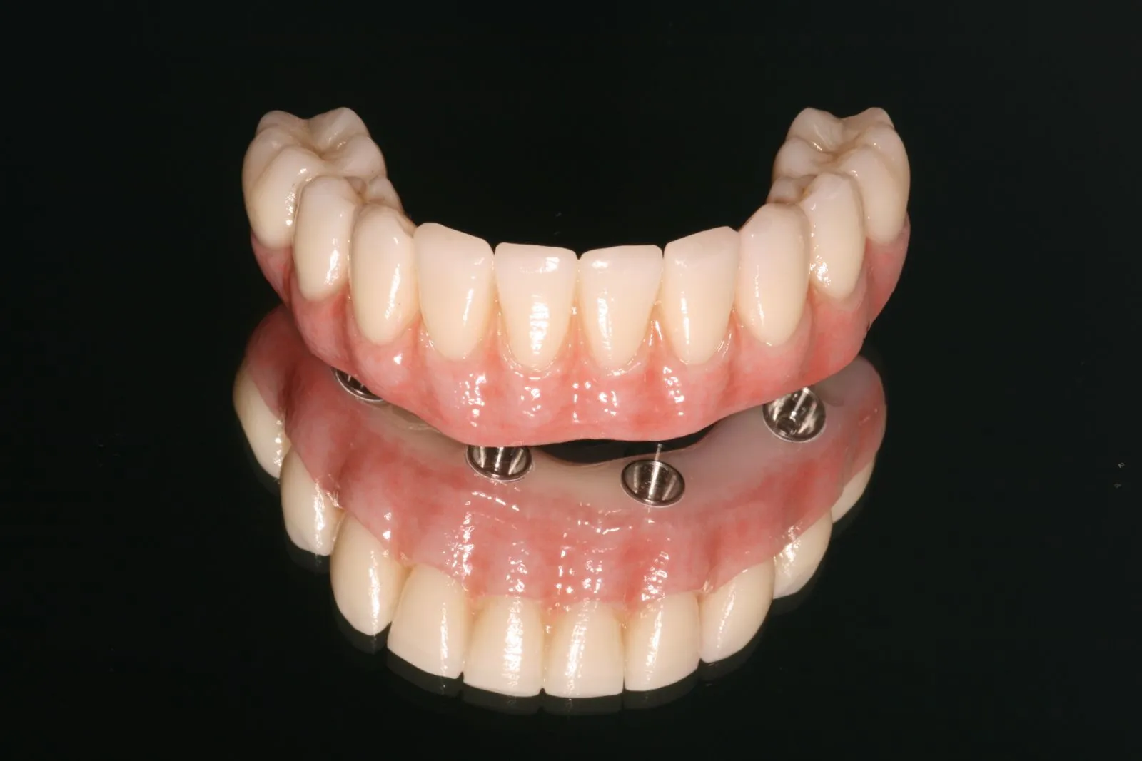 Full set of upper and lower dental implants with artificial teeth and pink gum bases on a black reflective surface.