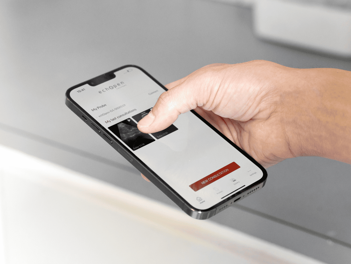 echOpen ON v3.0 : mesures précises sur image figée et Bladder Scanner AI