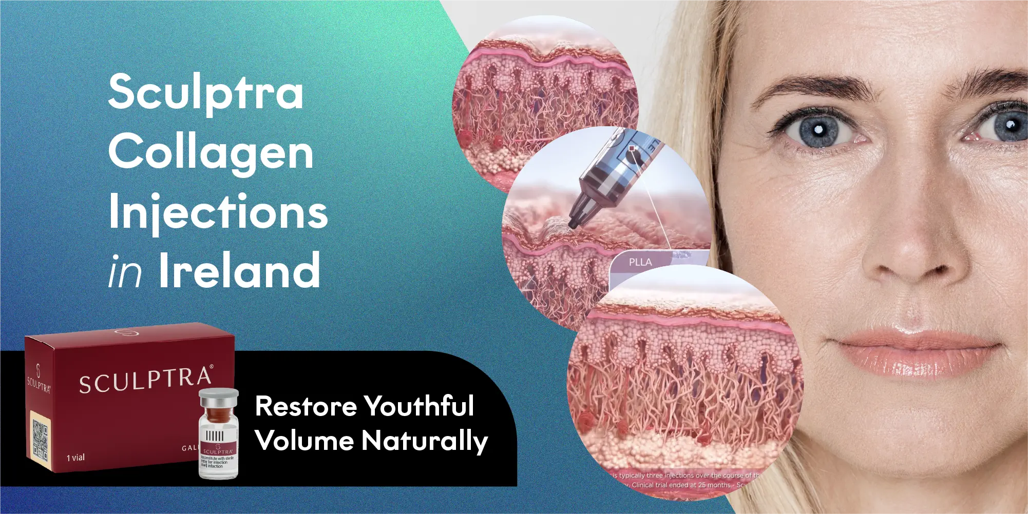 Sculptra Collagen Injections in Ireland: Restore Youthful Volume Naturally