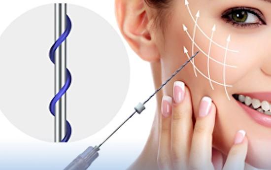 Chỉ collagen căng da mặt có đảm bảo hiệu quả hay không?