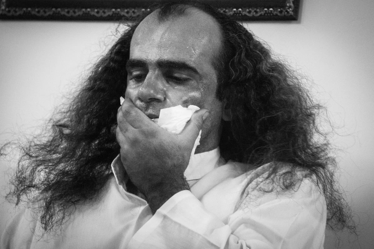 A dervish moments after removing a dagger from his cheek during the ceremony.