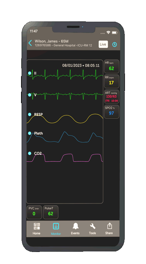 Patient Monitoring - Easy Access - Biometric Authentication