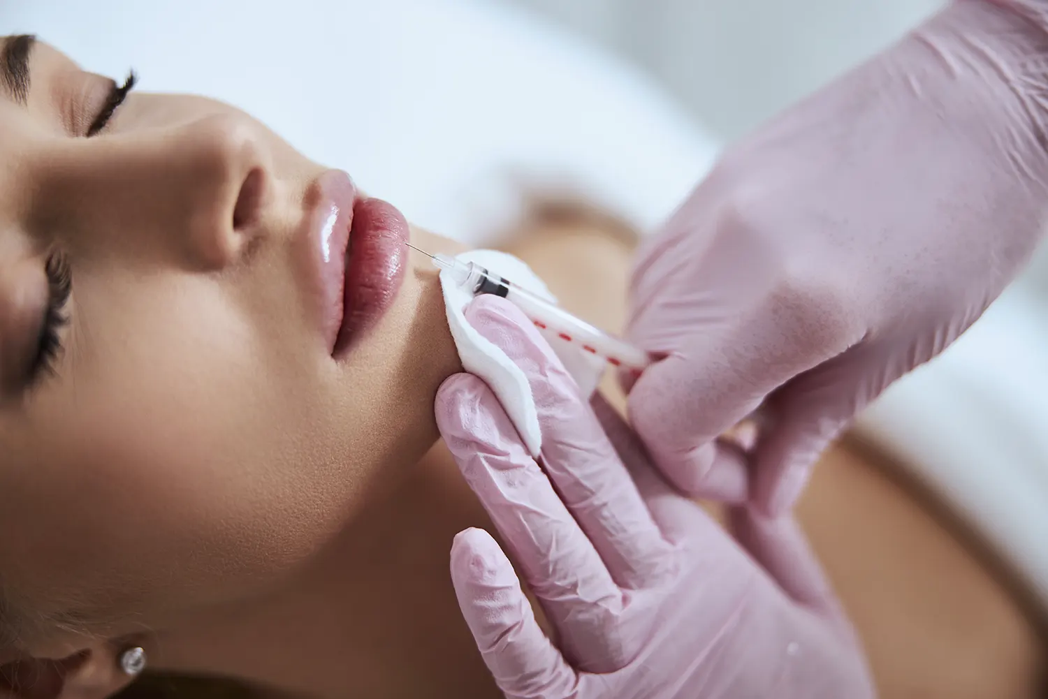 Botox in Memorial, Houston, TX | RH Dentistry of Memorial