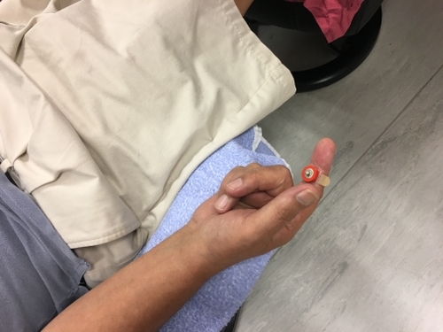 hand with electrode on a finger