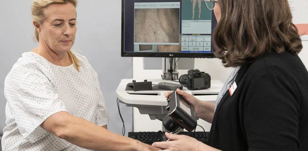 Full body mole mapping can detect the signs of skin cancer